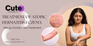 Allergy Contact Skin Treatment