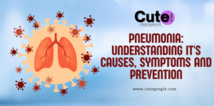 Community Acquired Pneumonia
